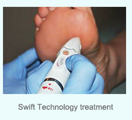 Treatment using swift